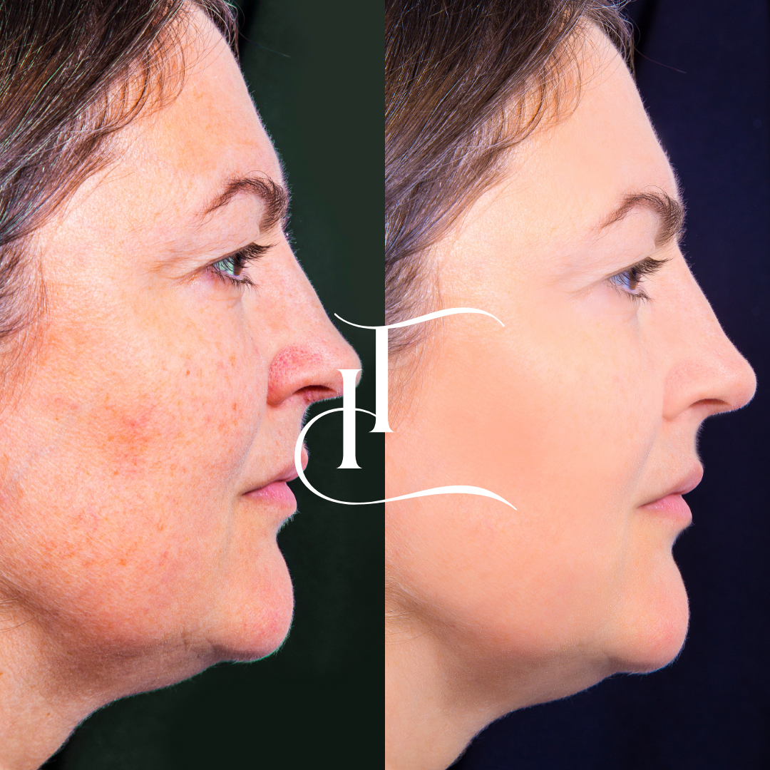 Especialista-em-Harmonizacao-Facial-19.png